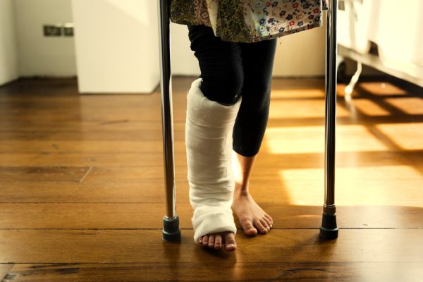 Young Caucasian girl with broken leg in plaster cast